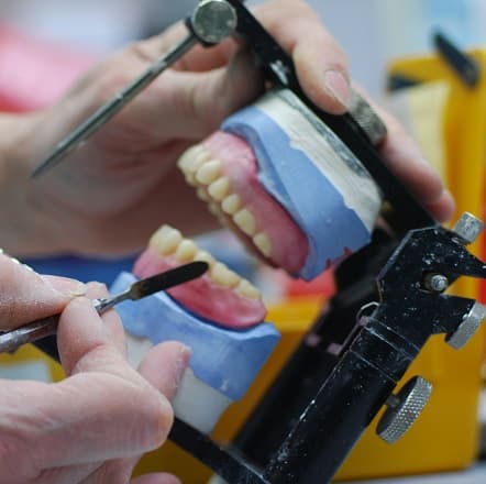 Volledige gebitsprothese