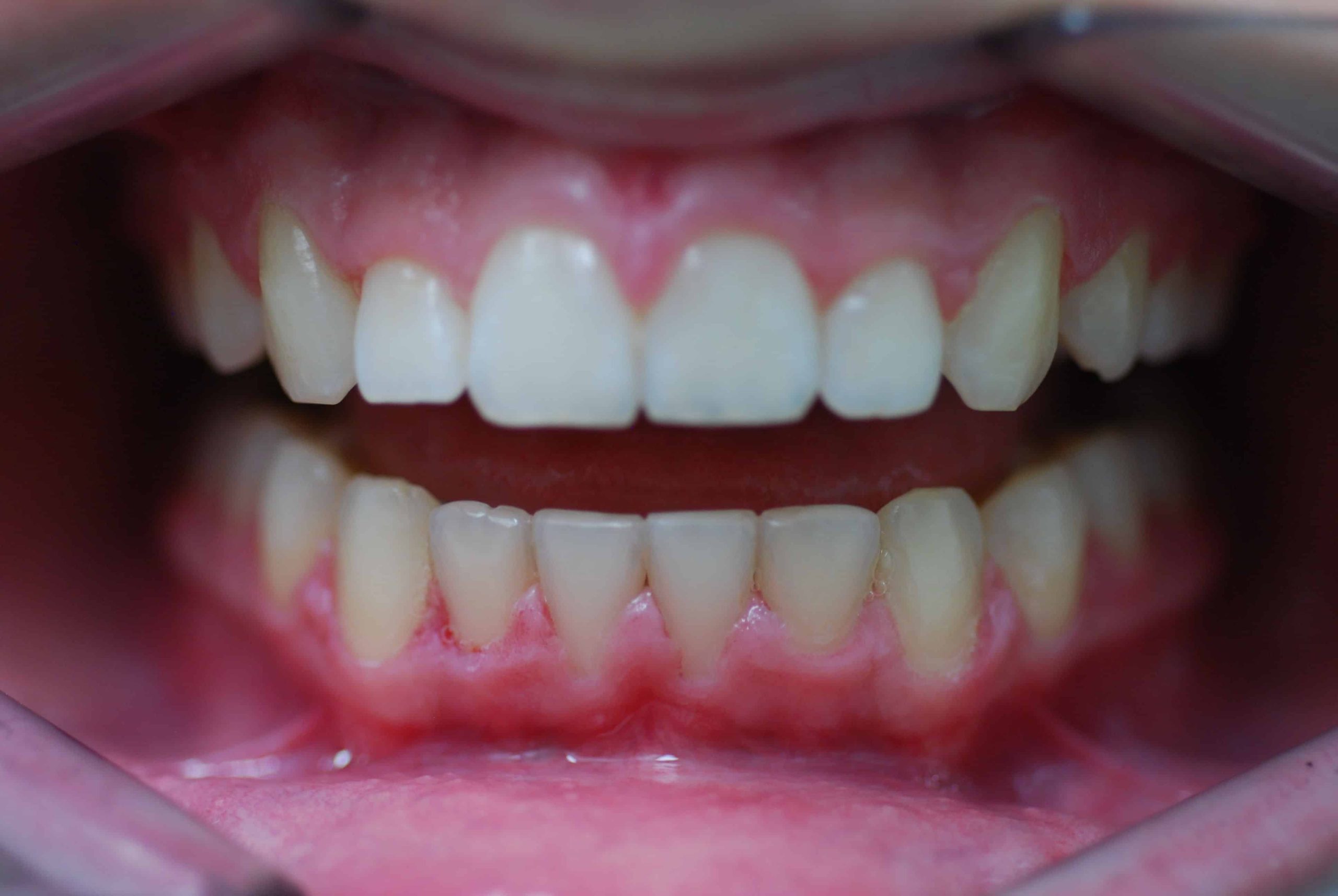 ternede 07-09-2016 1