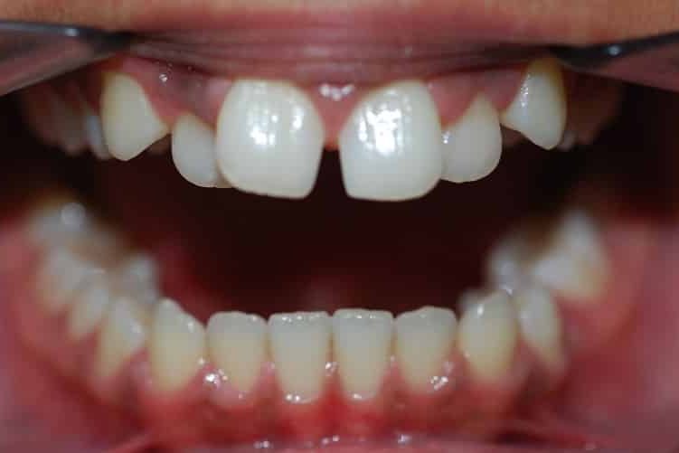 Beugelfoto-Nawal-1-voor-751x501