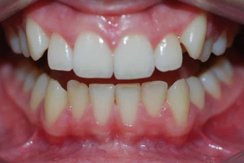 ternede-18-02-2015-1-update-797x532