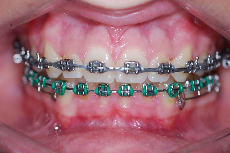 ternede-27-06-2016-update